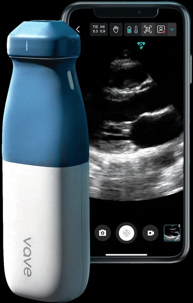 Американская компания Vave Health создала компактное устройство для УЗИ, которое помещается в карман брюк и работает в паре со смартфоном.